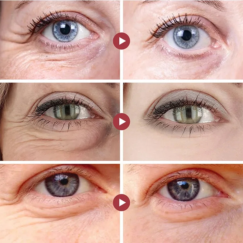 Parches para eliminar arrugas, - Eye Pad Collagen reseña y precio